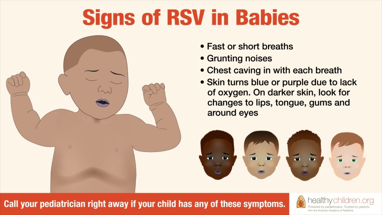 शिशुओं में श्वसन संक्रमण के लक्षण